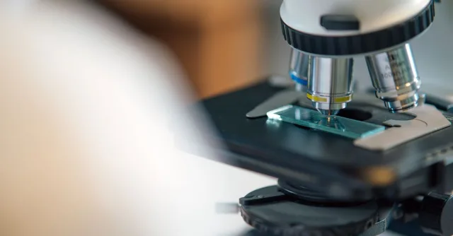 Detailed view of microscope slide setup, essential for biological research.